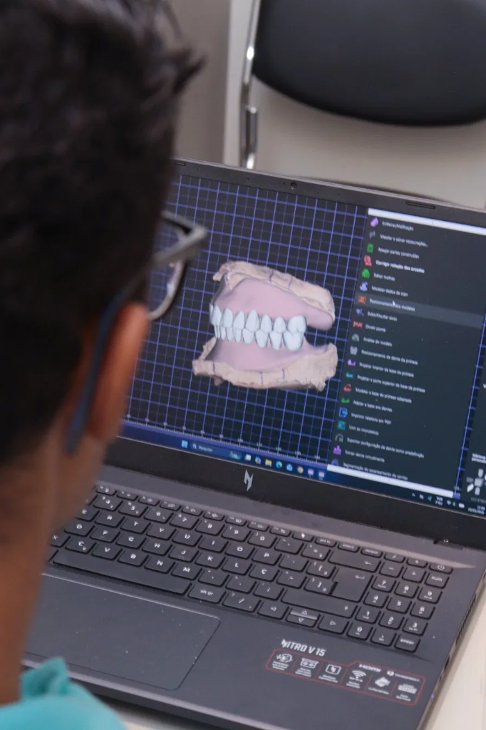 Profissional modelando prótese em software CAD no notebook